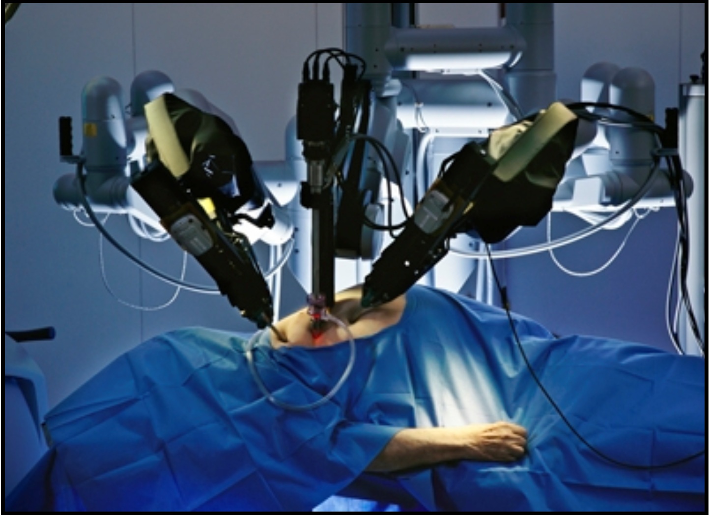robots in surgical procedures essay robots in surgical procedures essay